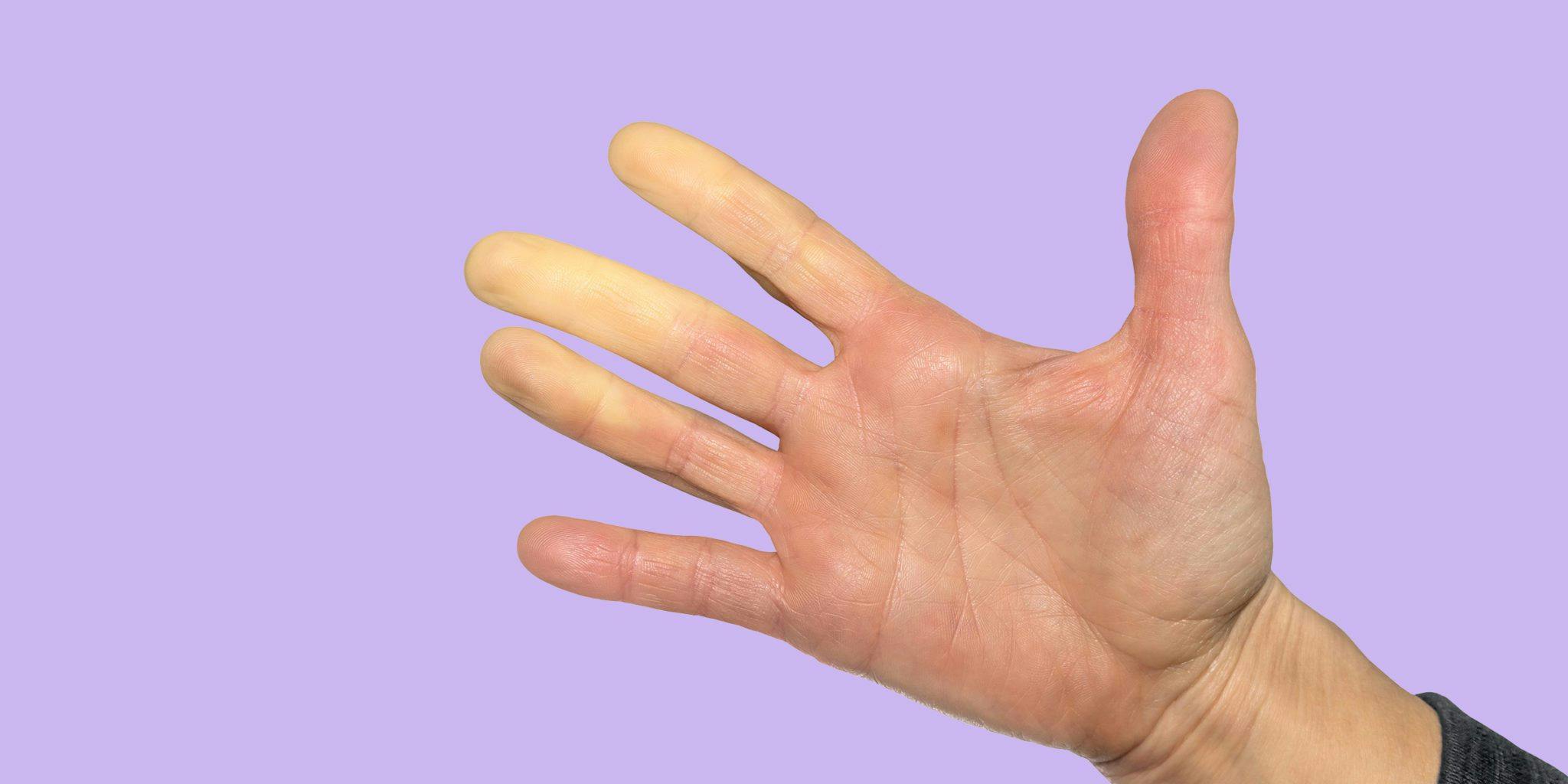 closeup of palm with yellowish fingers on a purple background