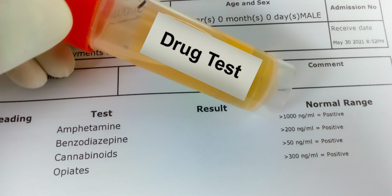 drug test sample and result